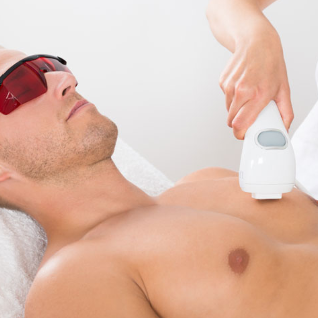 Male Chest Laser Hair Removal