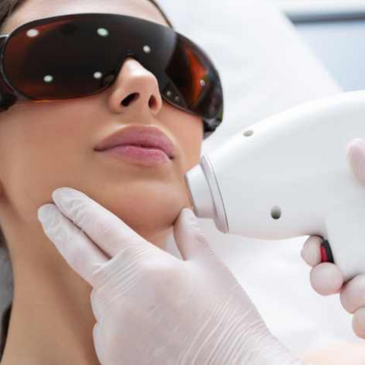 Chin Hair Removal